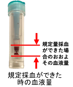フェリチン検査キット