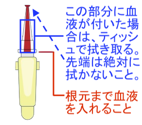 フェリチン検査キット